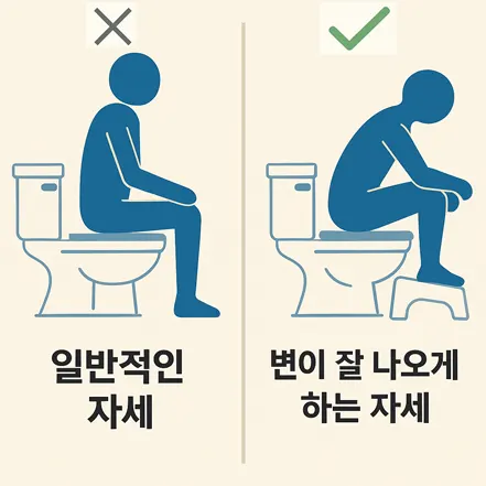 좌변기에서 변을 보는 일반적인 자세와 개선된 자세의 비교 이미지