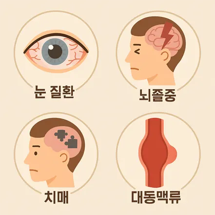 혈관 건강 악화로 발생하는 대표 질환 - 눈 질환, 뇌졸중, 치매, 대동맥류 일러스트
