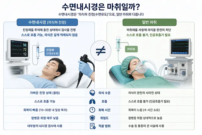 수면내시경과 전신마취의 차이점 및 의식 수준 호흡 회복 시간 위험도를 비교한 의료 인포그래픽