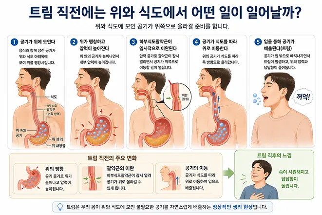 트림 직전 위에 모인 공기가 하부식도괄약근의 이완을 통해 식도를 따라 입으로 배출되는 과정을 설명하는 이미지
